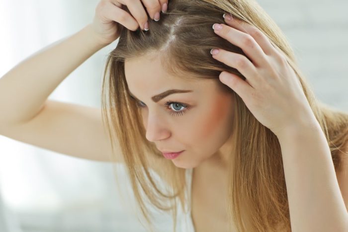 get rid of bugs in your hair